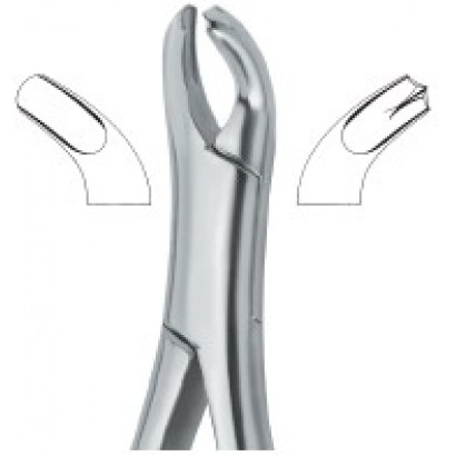 Harris Molars , left 18L